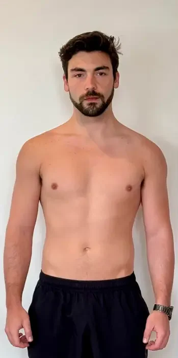 Transform 3 Before