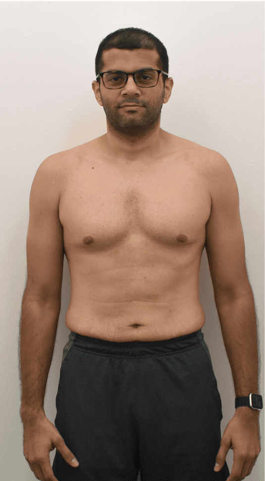 Transform 4 Before